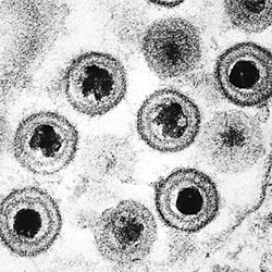 Herpes Simplex Virus under microscope Herpes Simplex Virus under microscope