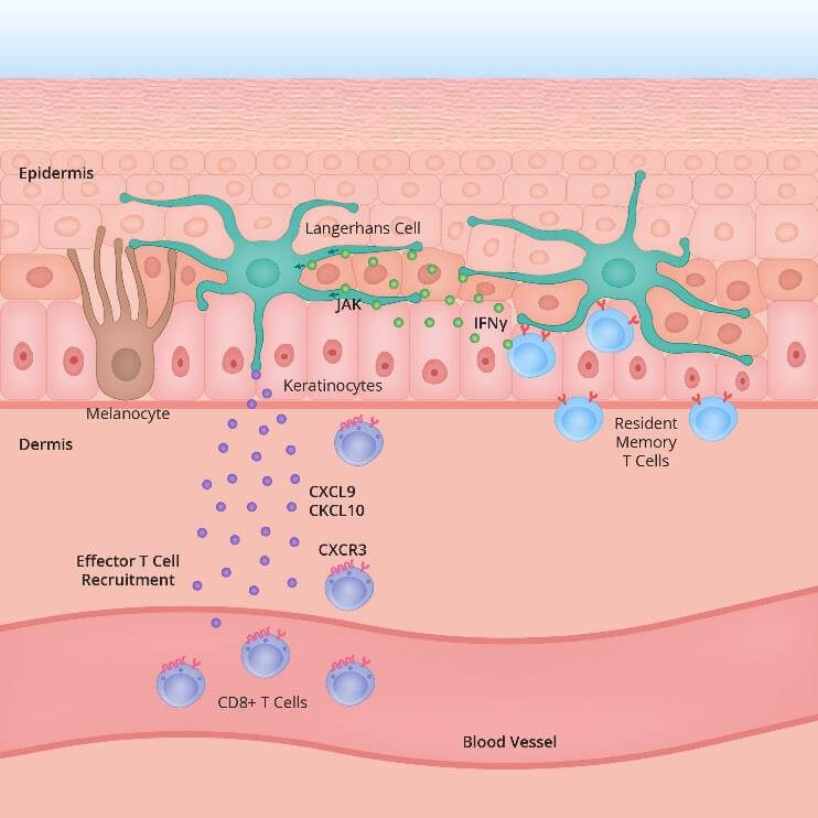 Figure 1: Melanocyte and signalling pathways including CD 9 T cells attacking the cell