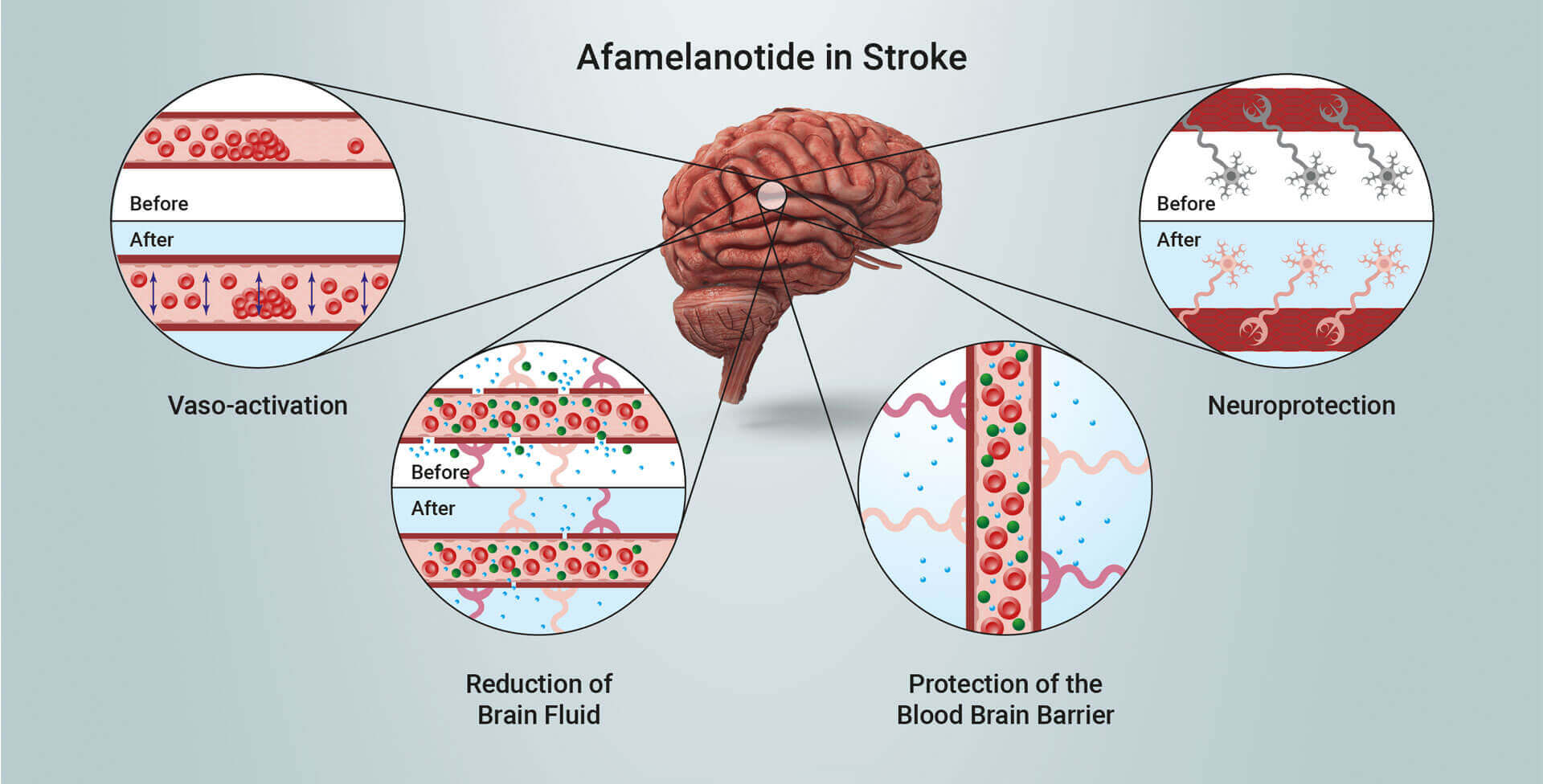 Afamelanotide in stroke