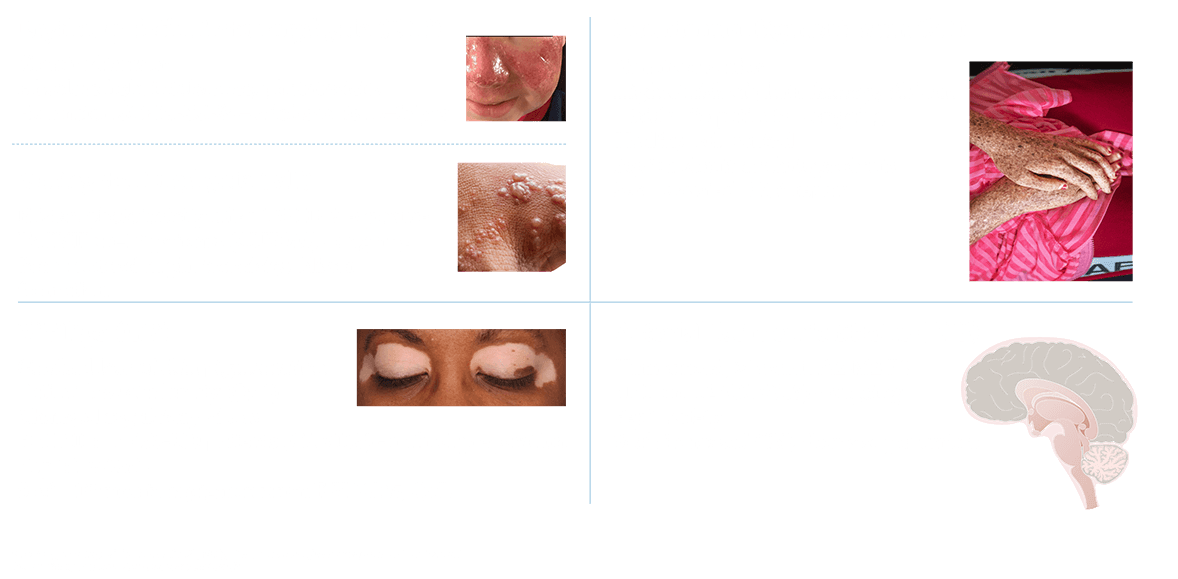 Strategic Update VI - Slide 6